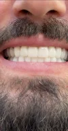 Özel Dent Natural Ağız ve Diş Sağlığı Polikliniği | Bakırköy Dis