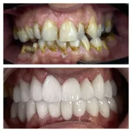 Özel A+ Plus Estetik Ağız ve Diş Sağlığı Polikliniği