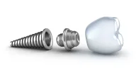 Dental Implant Clinic Trakya