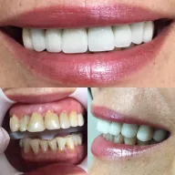 MHG Dental Klinik(Dt. Muhammed Hanifi Güllüce)