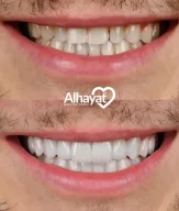 Alhayat clinic