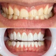 Dentadent Ağız ve Diş Sağlığı Merkezi