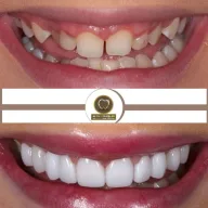 Golden Smile Beylikduzu