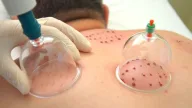 Bay ve Bayan Hacamat Merkezi - Evde Glutatyon Serum - Evde Kan Tahlili - Kulak Delme Ve Yıkama