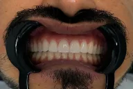LAMİS DENT Diş Clinic (diş hekimi Mustafa Türkmenoğlu)