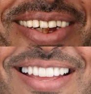 SM Dent Ağız ve Diş Sağlığı Polikliniği