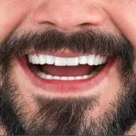 Türkiye Dental | Dental Implant | Hollywood Smile