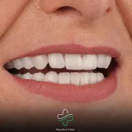 حياة دنت كلينيك - Hayatdent Clinic