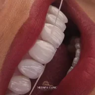 Medspa Clinic - Dental Implants, Hollywood smile, Dental clinic in Turkey