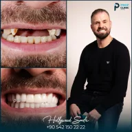 Prof Clinic | Dental Clinic Turkey