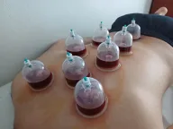 Bağcılar Hacamat & Sülük