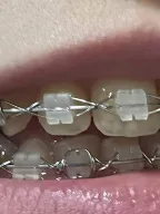 dentalprof by Ortodontist dental specialist clinics